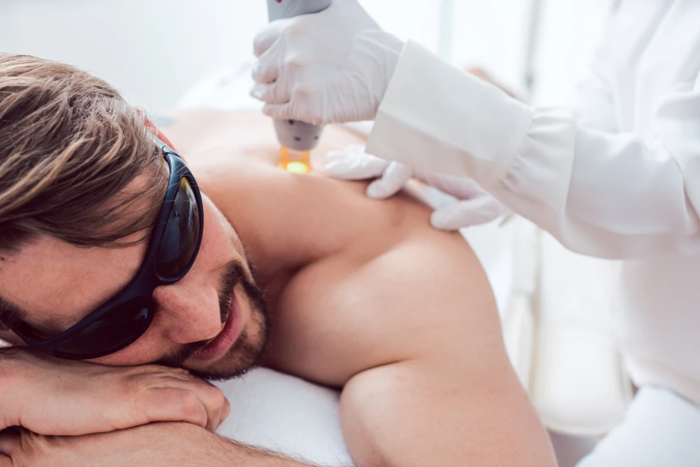 Man receiving laser hair removal on his back while wearing protective glasses.