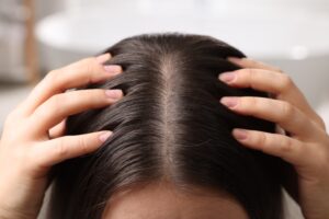 Hands holding apart sections of dark hair to show the scalp along a center part.