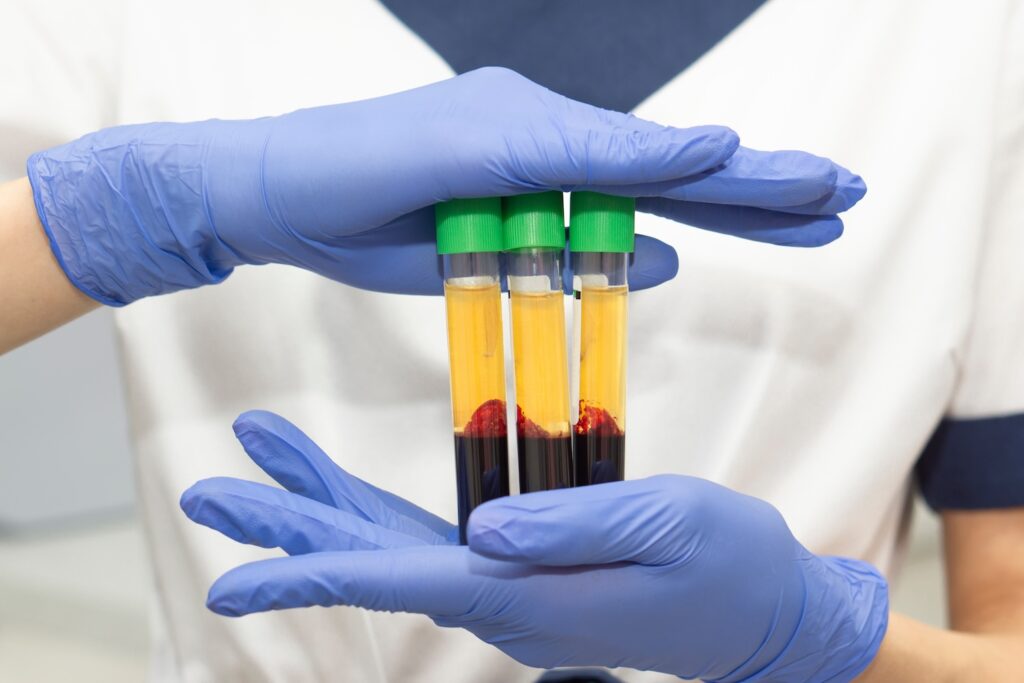 Gloved hands holding three test tubes containing separated blood components.