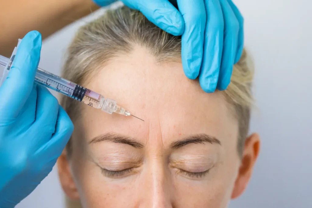 close-up of Botox injection targeting forehead lines with clinician wearing blue gloves